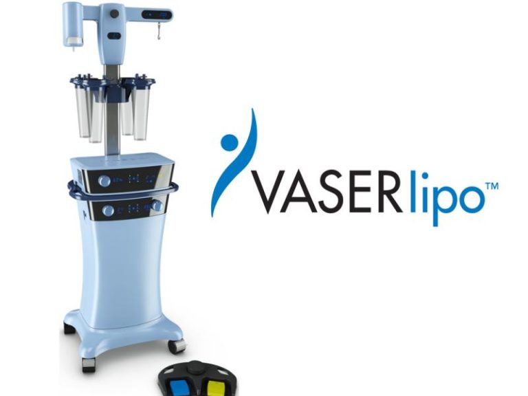 Vaser Lipo 768x576